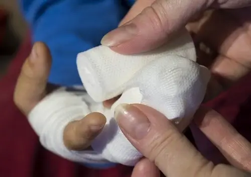 use of honey wound dressing use of honey wound dressing